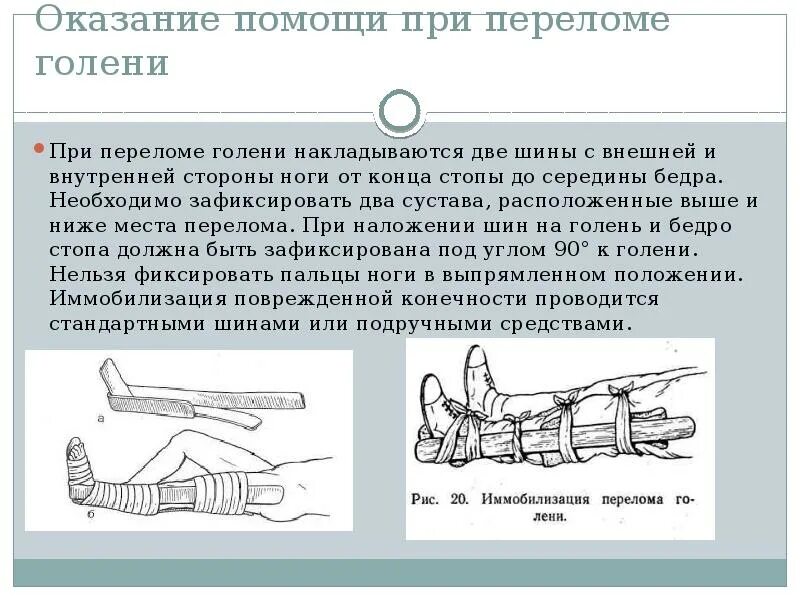 Перелом голени транспортировка. Порядок наложения шины при переломе голени. Наложение шины Крамера при переломе костей голени. Иммобилизация конечности при переломе наложение шины Крамера. Транспортная иммобилизация при переломах костей.