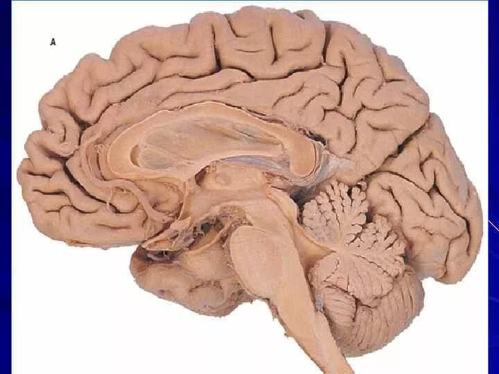 Головного мозга на ранних. Genu of Corpus callosum. Мозолистое тело Corpus callosum. Splenium corporis callosi анатомия.