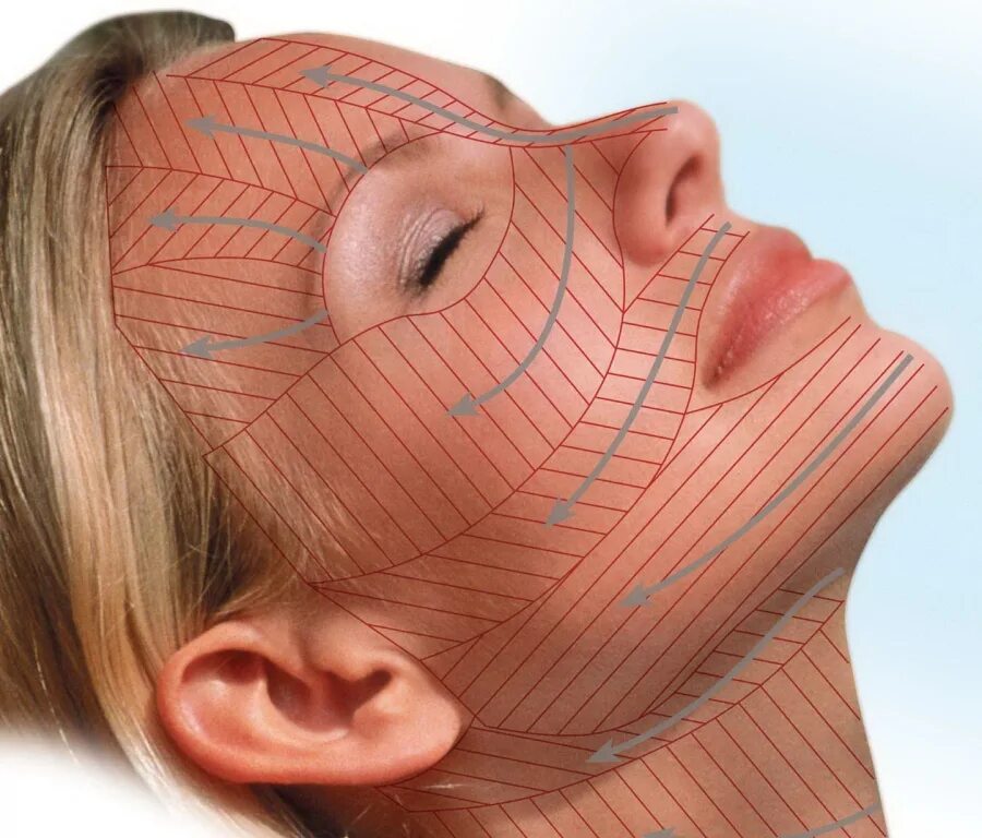 Армировать лицо. Нитевое армирование лица. Нитевой лифтинг аптос. Биоармирование кожи вокруг глаз. Лифтинг aptos.