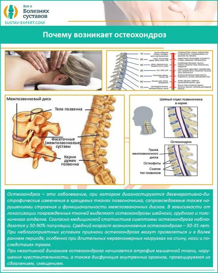 Заболевания позвоночника. Остеохондроз шейного отдела позвоночника. Грудной отдел позвоночника. Остеохондроз позвоночного отдела. Остеохондроз шейного и грудного отдела позвоночника лечение