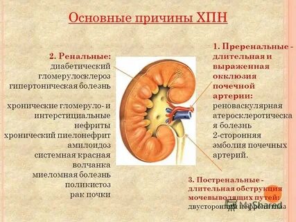 Синдромы при пиелонефрите
