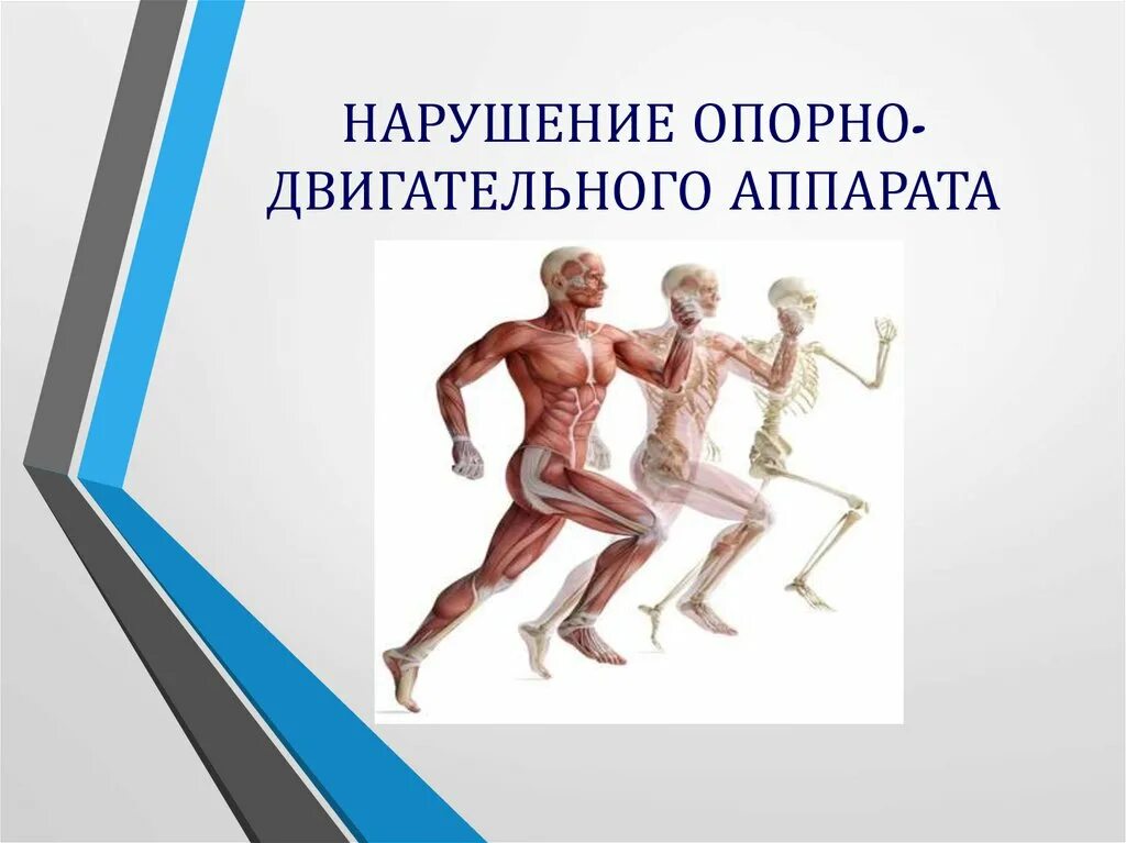 Связанных с опорно двигательным. Нарушение опорно-двигательного аппарата. патология двигательного аппарата. нарушение функций опорно-двигательного аппарата. опорно двигательный аппарат в движении.