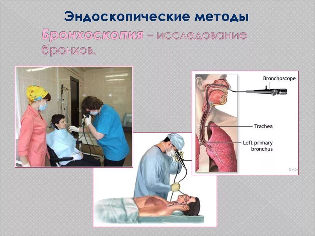 Подготовка к бронхографии алгоритм