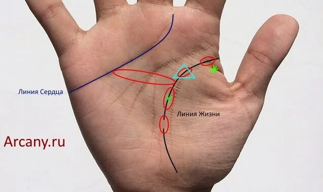 Остов что означает. Остров на линии жизни. Островок на линии жизни. Хиромантия остров на линии жизни. Ладони остров на линии жизни.