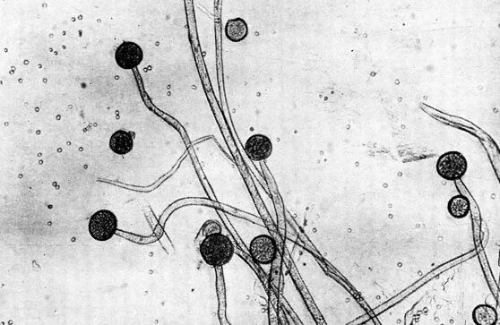 Клетка гриба мукор