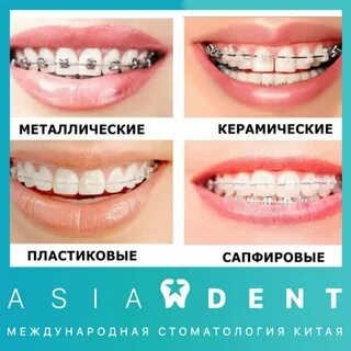 Сколько дней болят брекеты