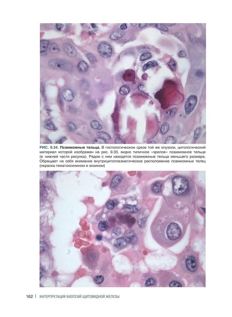 Интерпретация биопсий желудочно-кишечного тракта. Интерпретация биопсий желудочно-кишечного тракта. Интерпретация биопсий желудочно-кишечного тракта. Неопухолевые поражения слизистой оболочки. Интерпретация биопсий.