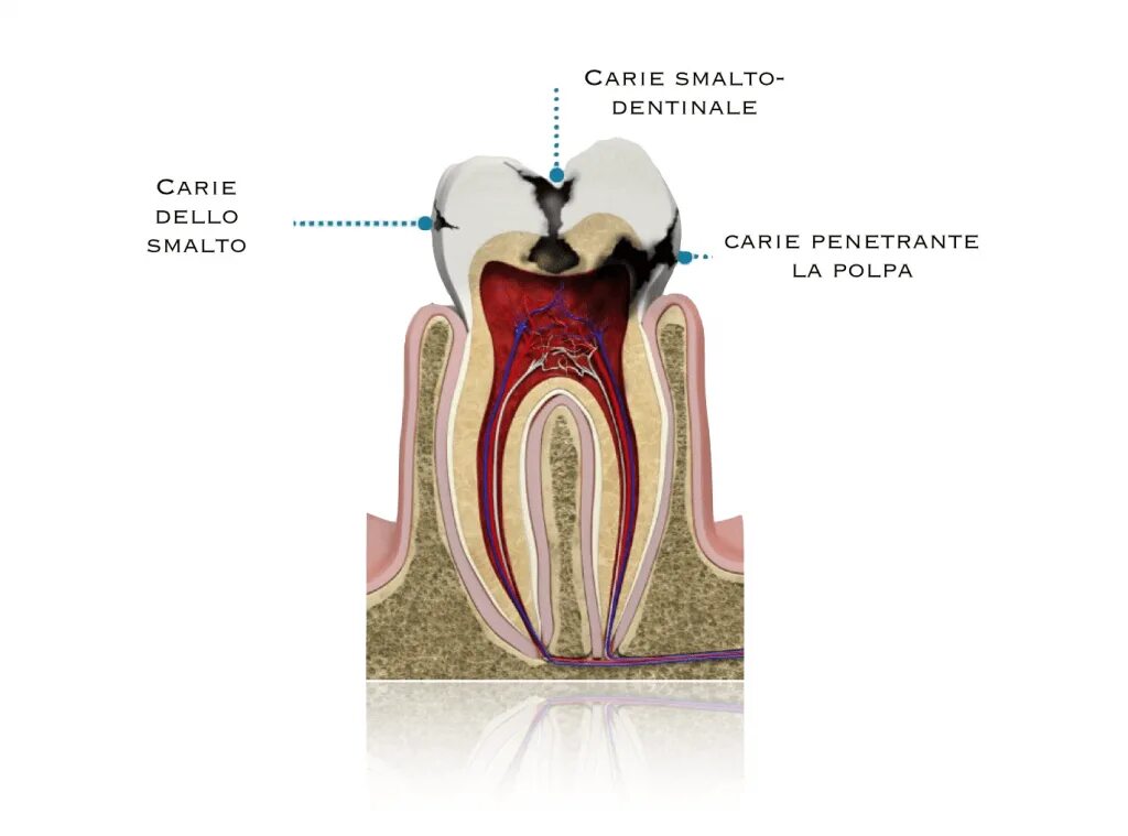 Картинки cin кольпоскопия. Spread into. Spread into. How to make pizza step by step. Swiss lake baked cookie название цвета.