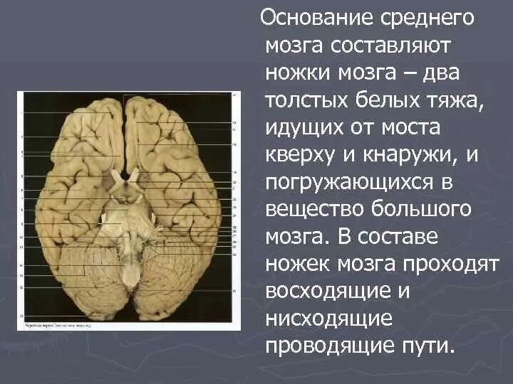 Препарат среднего мозга. Средние ножки мозга. Ножки среднего мозга.