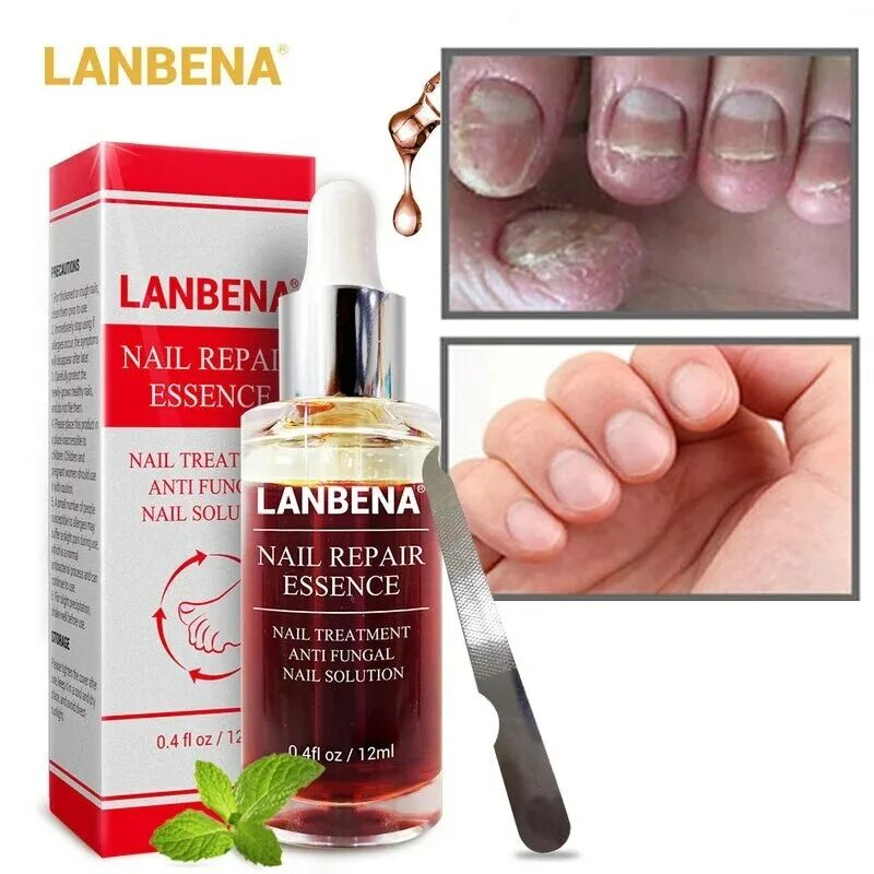 Сыворотка для восстановления ногтей Nail fungal solution. LANBENA сыворотка для ногтей. Средство от грибка ногтей LANBENA Nail Repair Essence 15 ml.