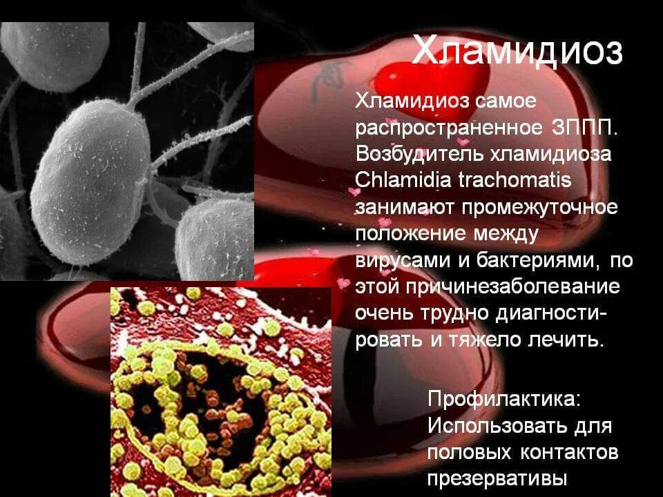 Хламидиоз симптомы возбудитель. Венерические заболевания презентация. Возбудители венерических заболеваний. Заболевания передающиеся половым путём.