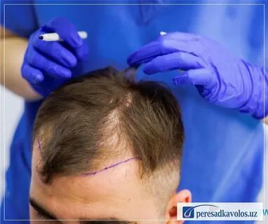 Experience Riyadh Hair Center