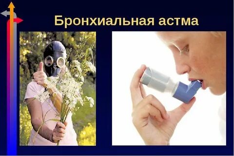 Первичная астма
