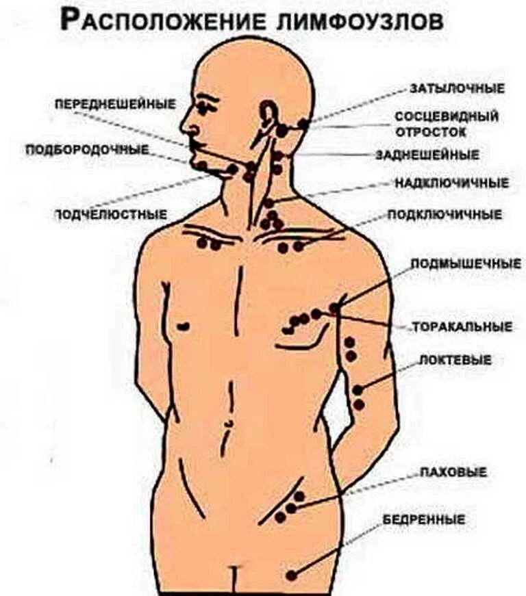 Лимфатические узлы человека схема расположения. Лимфатические узлы на теле человека схема у мужчин. Где находятся лимфатические узлы у человека фото. Схема лимфоузлов на теле человека на шее. Где у женщины расположены лимфоузлы