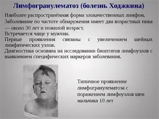 Прогноз лимфом у детей. Прогноз лимфом у детей