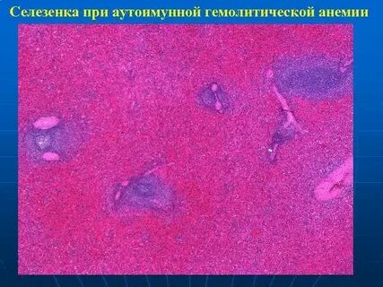 Селезенка гемоглобин