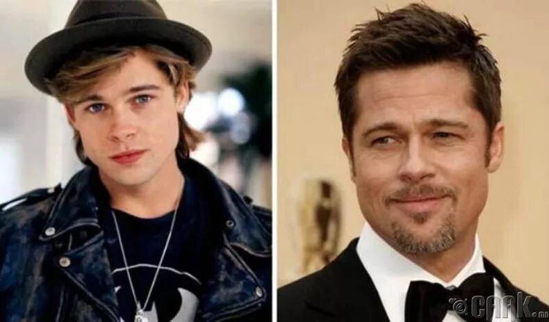 Отопластика Брэда Питта. Брэд Питт отопластика. Brad Pitt Plastic Surgery. Брэд Питт до операции.