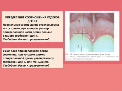 Характеристики десны