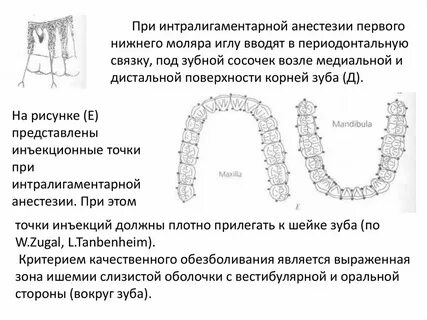 Обезболивающие при удалении зуба