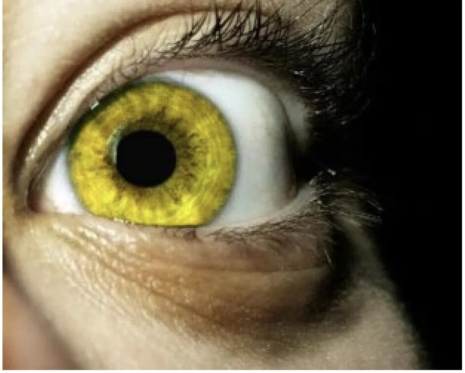 Желтый глаз 8. Желтые глаза. Натуральные желтые глаза. Серо желтые глаза. Жёлтые глаза у человека.
