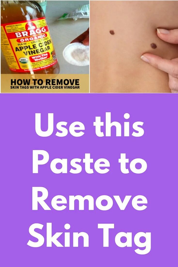 Remove tags. Remove tags