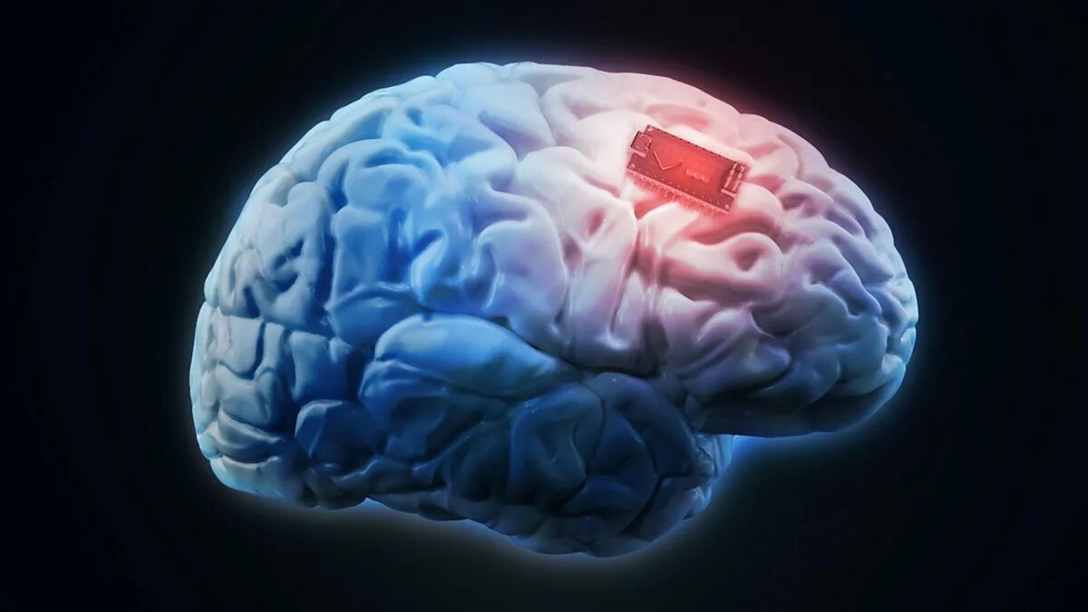 Мозг память. Импланты для улучшения памяти.