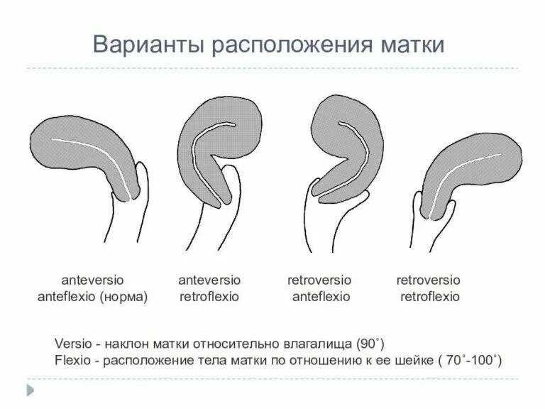 Почему Из Влагалища При Сексе Звук