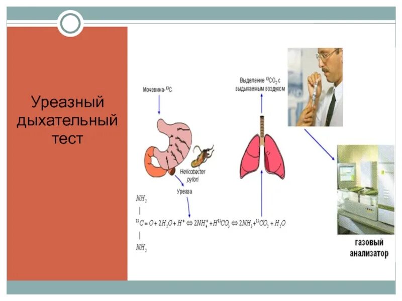 Нужен дыхательный тест. Дыхатепльный уреащный тесь. Уреазный дыхательный тест. Уруреазный тест дыхательный. Уреазный тест с мочевиной.