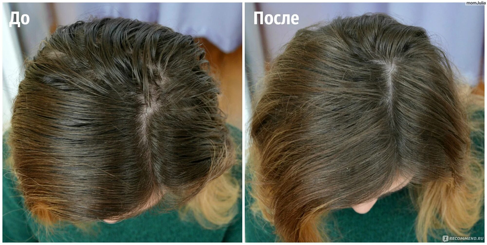 Сухой шампунь до и после. Сухой шампунь для волос эффект до и после. Шампунь для сухих волос. Волосы после сухого шампуня