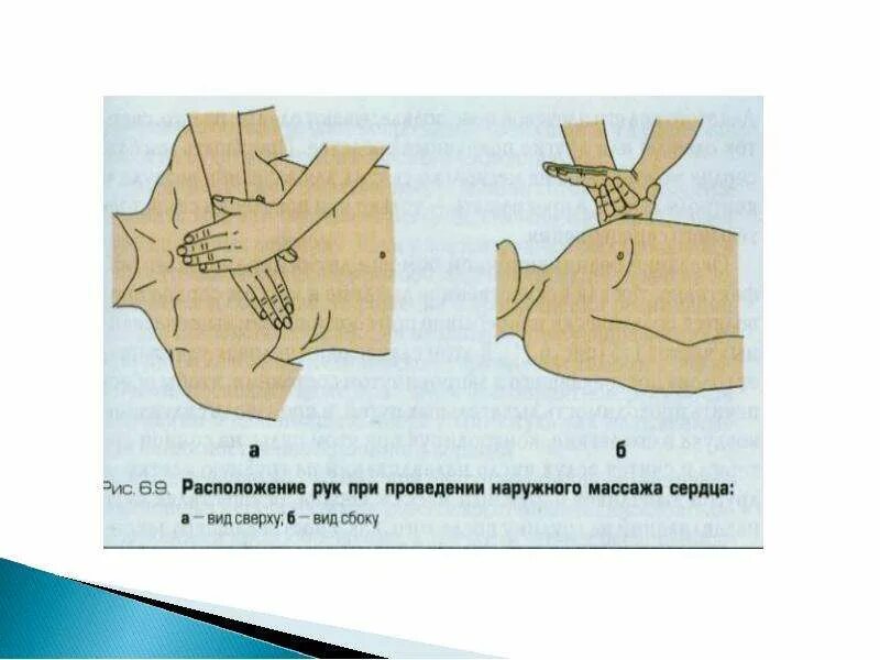 Местоположение рук