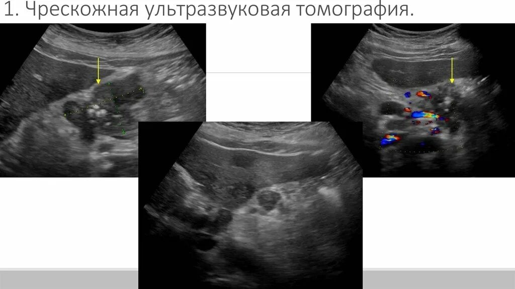 Новик узи. Новик узи. Новик узи. Аппарат узи. Беденков никита вадимович.