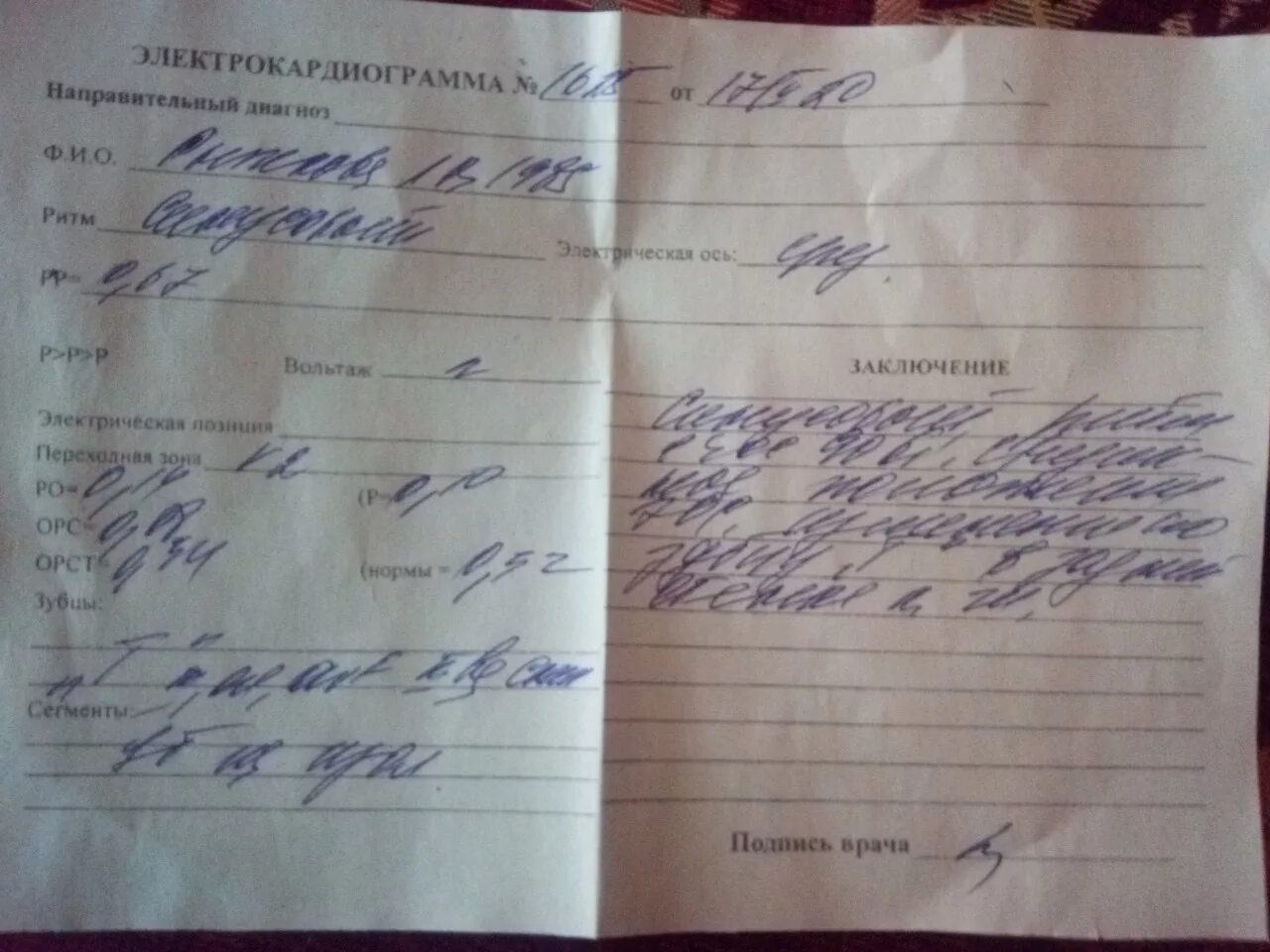 Нарушение реполяризации диффузного характера. Нарушение процессов реполяризации в заключении экг. заключение экг нарушения процессов. заключения экг нарушение процессов реполяризации по нижней стенке. нарушение реполяризации нижней стенки на экг.