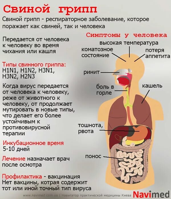 Аппетит после температуры. Свиной грипп. Свиной грипп симптомы. Свиной грипп симптомы у людей.