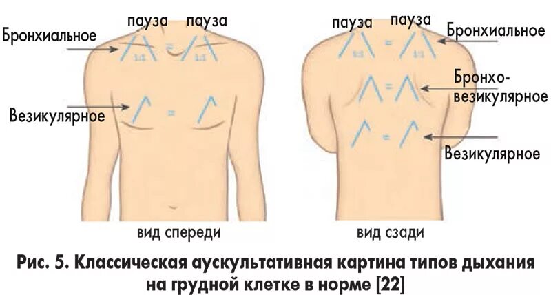 Измерение окружности грудной клетки. Схема аускультации легких везикулярное дыхание. Пауза грудной клетки. Окружность грудной клетк. Пауза грудной клетки.