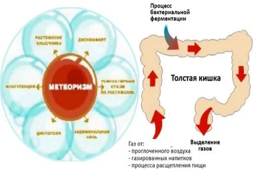 Таблетки от газообразования в кишечнике. Повышенное газообразование в кишечнике лекарства. Образование газов в кишечнике. Вздутие живота и газообразование. Сильное образование газов