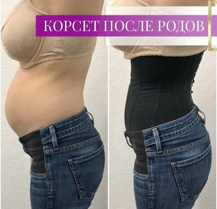 Корсет до и после родов. Послеродовой бандаж после кесарева сечения. Бандаж крейт для беременных. Можно ли корсет после родов. Можно ли корсет после родов.