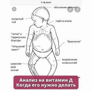 Симптом четок
