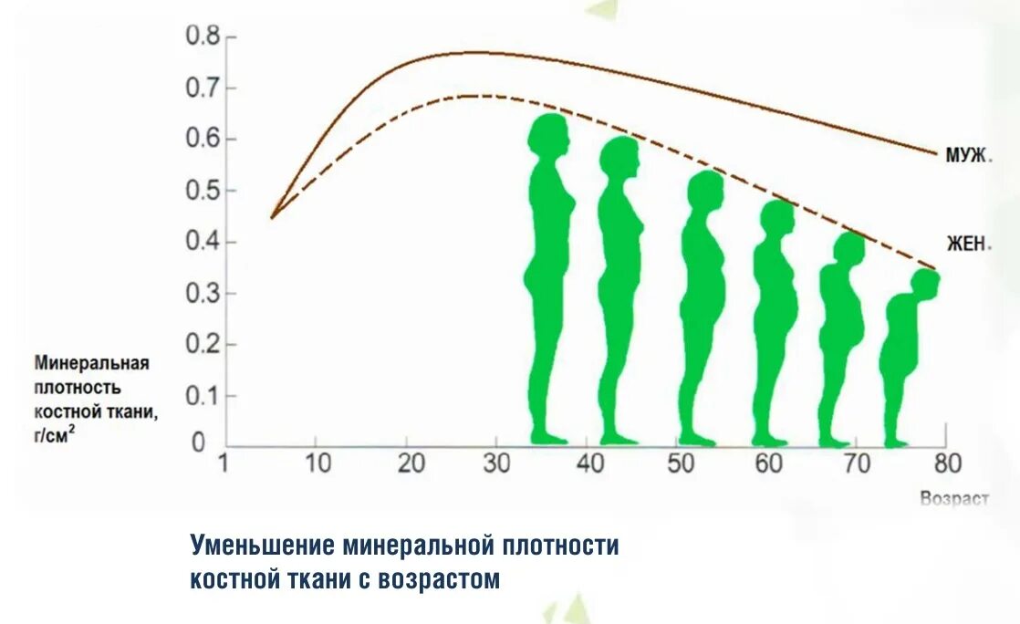 Уменьшение костной массы. Плотность костной ткани. Уменьшение костной массы с возрастом. Снижение минеральной плотности костной ткани. Почему с возрастом снижается