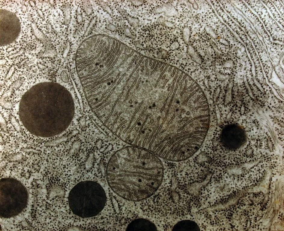 клетка в электронном микроскопе. ядрышко электронограмма. ядро клетки микрофотография. гепатоциты микрофотография. ядро клетки в электронный микроскоп.