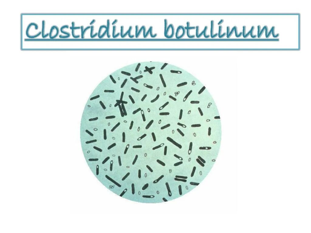 Clostridium botulinum адгезины. Clostridium botulinum подвижность. Клостридиум ботулинум этиология. Ботулотоксин клостридиум.