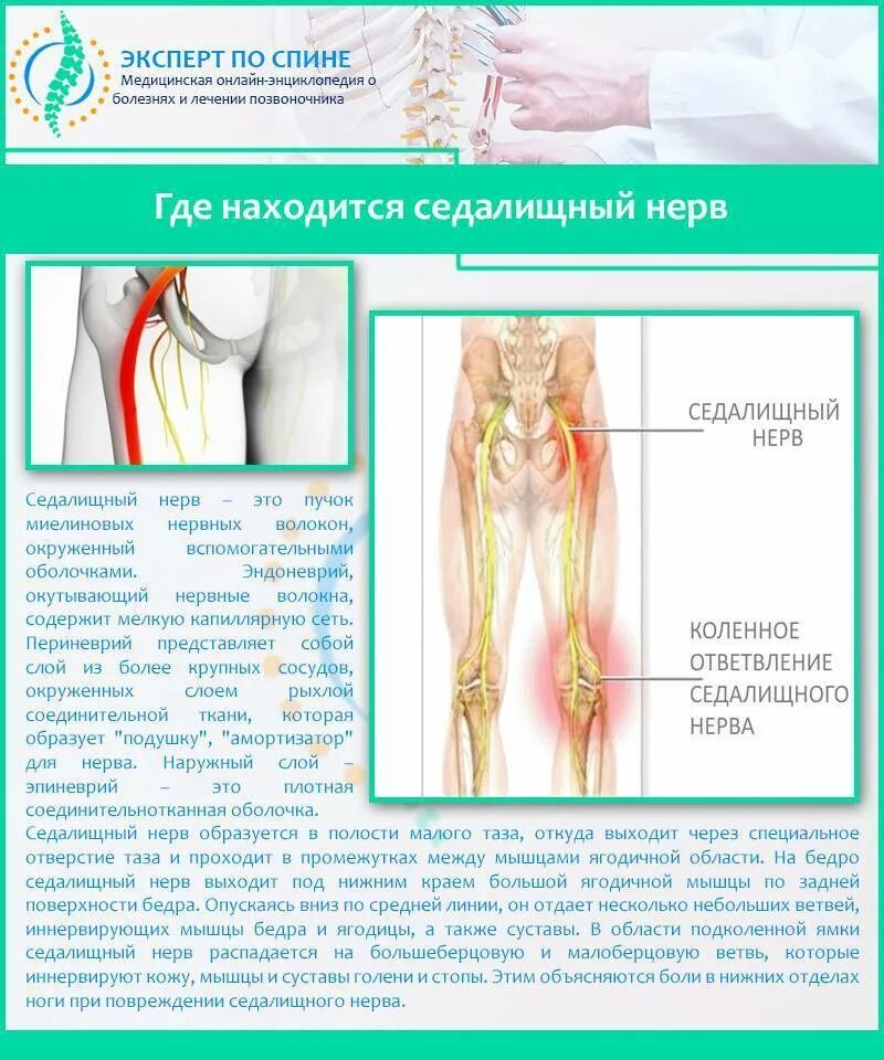 Седалищный нерв схема. Защемление седалищного нерва. Защемило седалищный нерв симптомы. Седалищный нерв анатомия ветви.