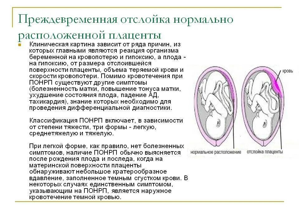 Предлежание плаценты 32 недели беременности. Преждевременное старение плаценты на 32 неделе беременности. Преждевременная отслойка предлежащей плаценты. Предлежание плаценты и отслойка нормально расположенной плаценты.