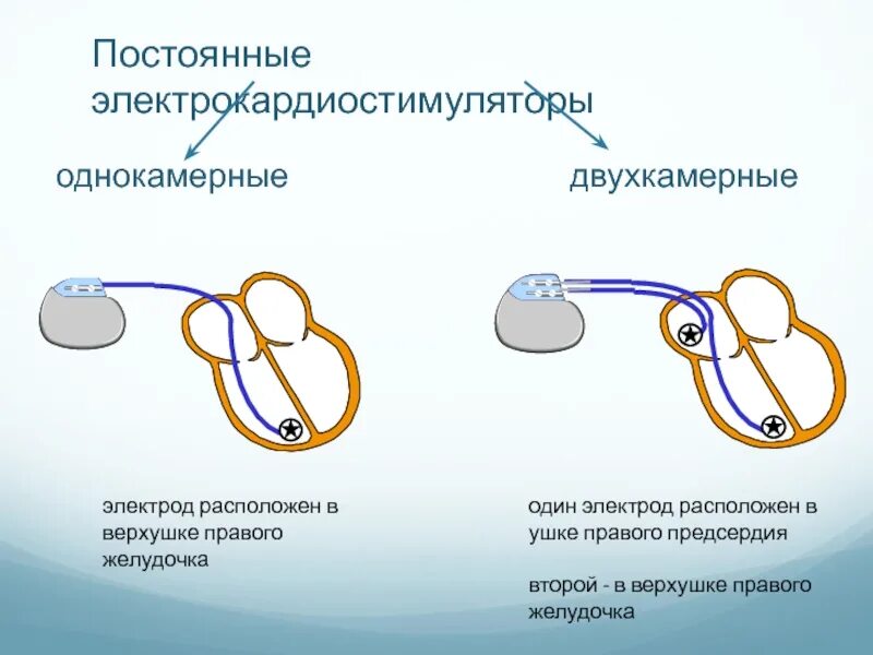 Как работает стимуляция