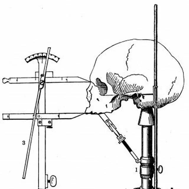 Черепной индекс. Основные краниометрические точки черепа. Краниометрия антропология. Точки измерения черепа. Формы черепов.