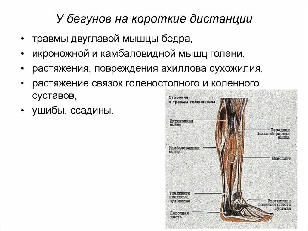 Отрыв икроножная мышца анатомия. Сухожилие камбаловидной мышцы. Растяжение камбаловидной мышцы симптомы. Разрыв камбаловидной мышцы симптомы.