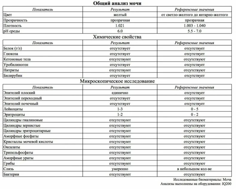 Почему повышается в моче. Эпителий плоский в моче норма таблица. Общий анализ мочи расшифровка эпителий плоский. Общий анализ мочи эпителий норма. Нормальные показатели ОАМ У мужчин.