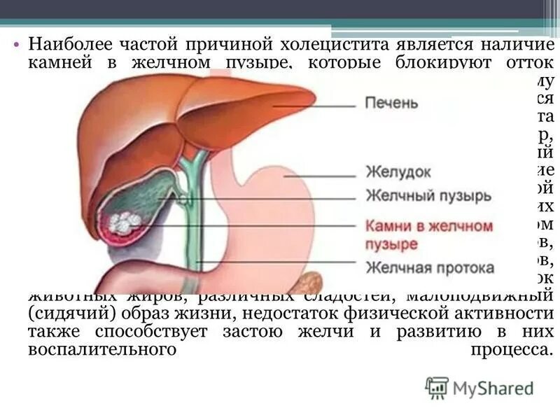 Симптомы плохого оттока желчи