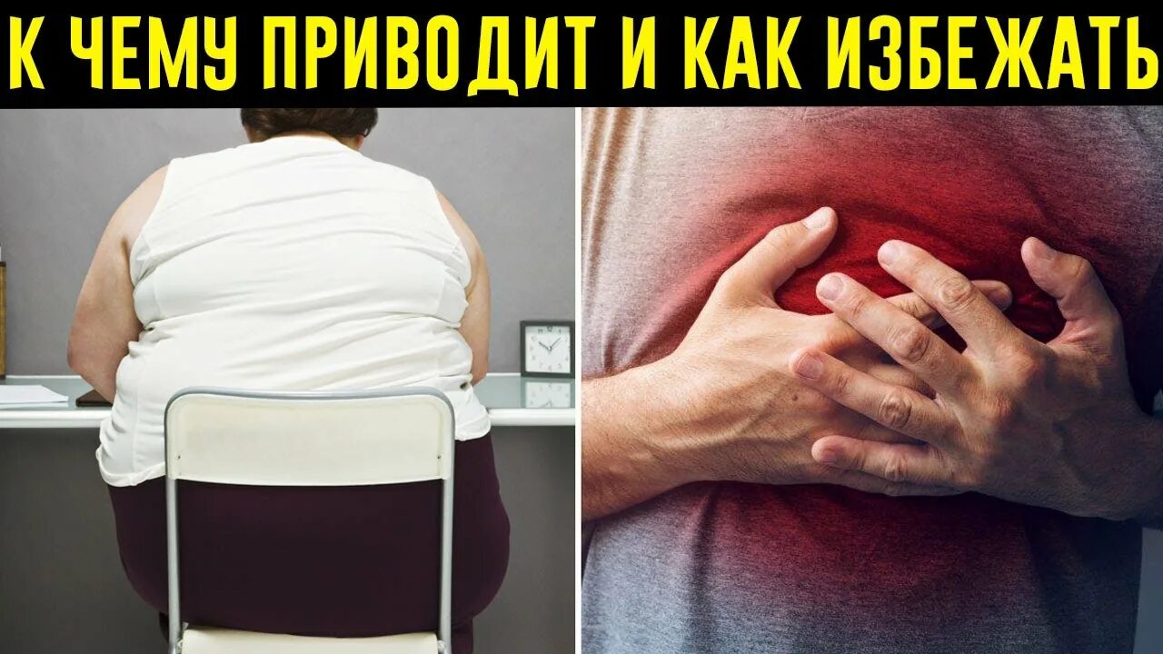 К чему приводит ожирение. Сидячий образ жизни ожирение. ожирение от сидячего образа жизни.