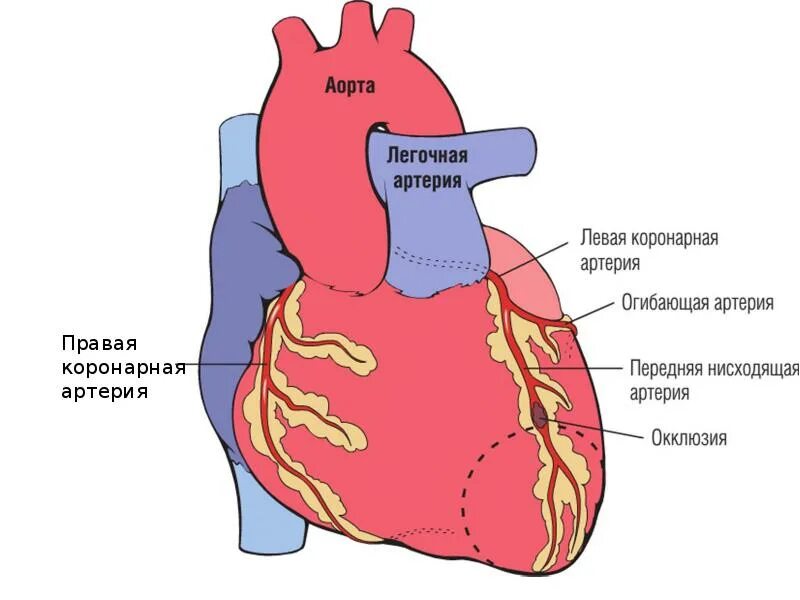 Коронарная ишемия. Аорта и коронарные артерии. Правая коронарная артерия. Болезнь коронарных артерий. Коронарная болезнь сердца.