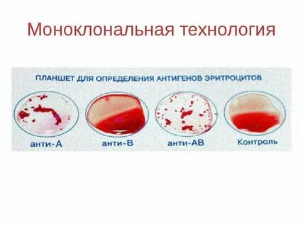 Антитела в иммуногематологии ответы нмо